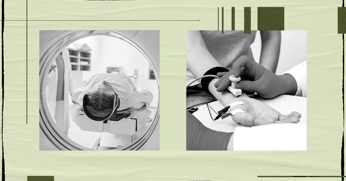 What tests help doctors diagnose thoracic outlet syndrome?