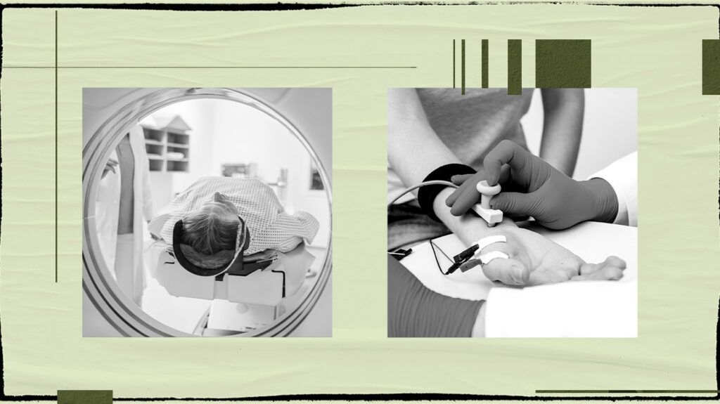 Thoracic outlet tests: Types, purpose, and risks