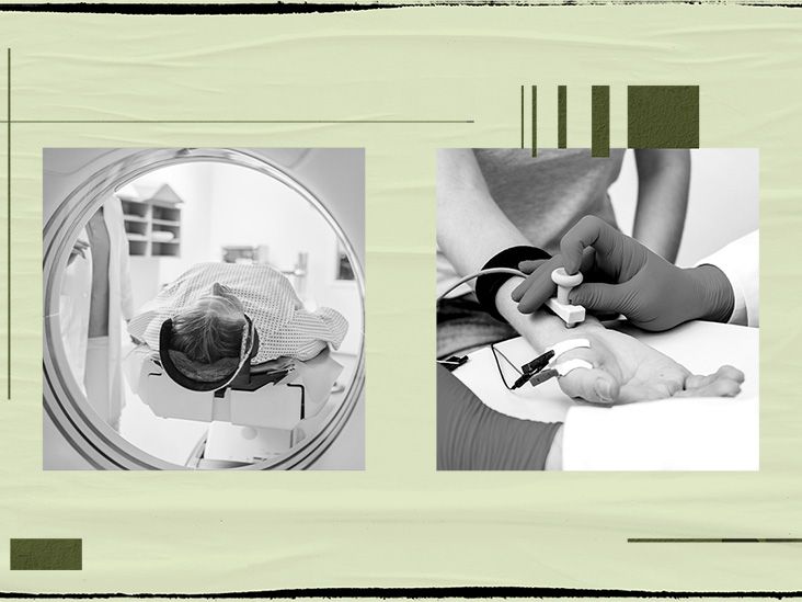 What tests help doctors diagnose thoracic outlet syndrome?