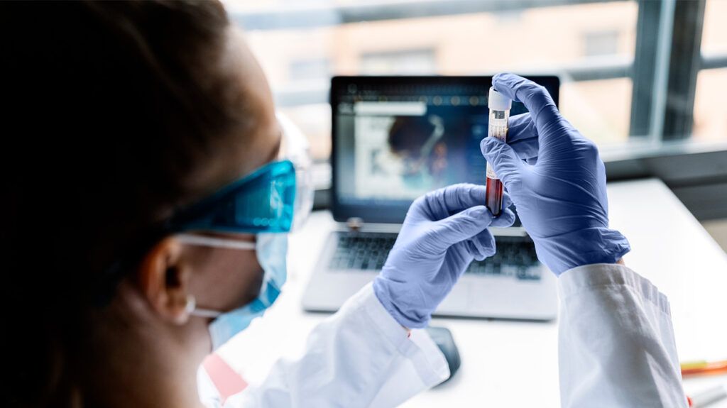 A scientist holding a tube of blood for further testing in front of a computer screen in a lab