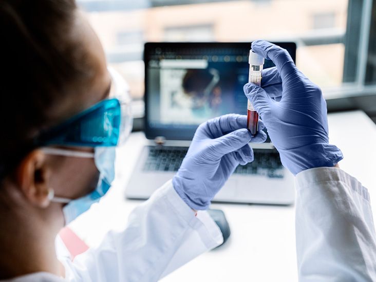 New blood test may help diagnose chronic fatigue syndrome with 96% accuracy
