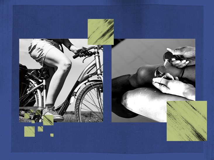 What exercises are best for knee osteoarthritis? Study offers clues