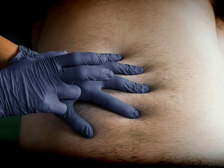 What conditions can people mistake for Crohn's disease, and when should they see a doctor?