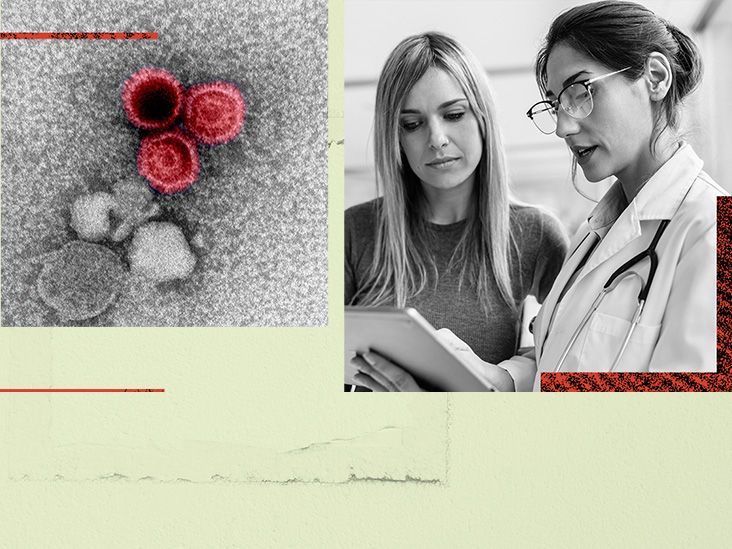 Study links lupus to common virus that infects 95% of adults