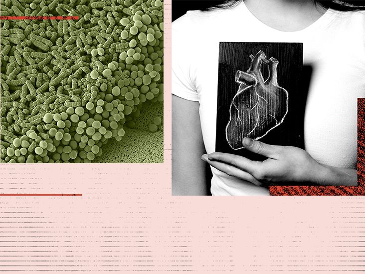 Changes in gut bacteria may be a warning sign of heart disease