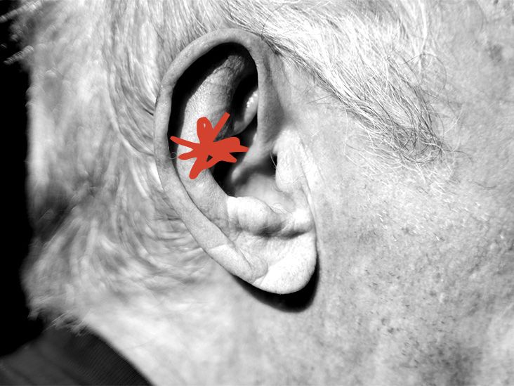 Midlife hearing loss could increase dementia risk, study finds