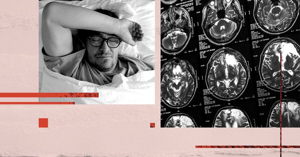 Sleep quality may increase dementia risk: Latest evidence Sleep quality may increase dementia risk: Latest evidence