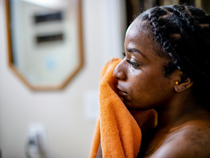 How cold sores affect dark skin, with pictures
