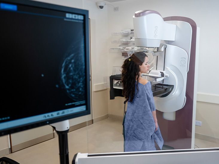 AI-assisted mammograms could cut risk of developing aggressive breast…
