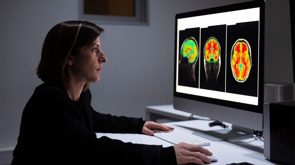 A healthcare professional looking at brain MRI scans.