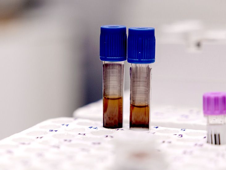 Could anemia increase the risk of developing dementia?