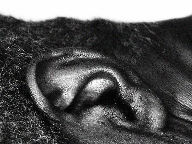 Does serotonin play a role in tinnitus? Mouse study raises question