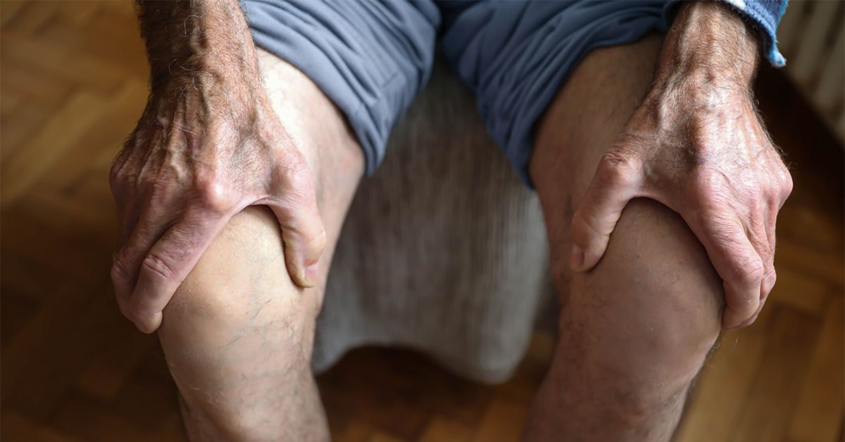 Surgery may worsen knee osteoarthritis, study says, so what could help? Surgery may worsen knee osteoarthritis, study says, so what could help?