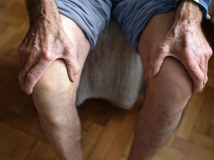 Surgery may worsen knee osteoarthritis, study says, so what could help?