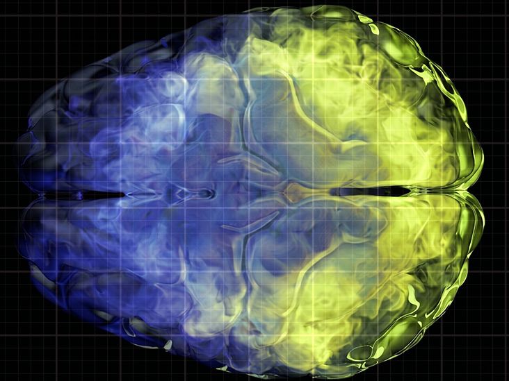 Vitamin C may help preserve brain gray matter volume as we age
