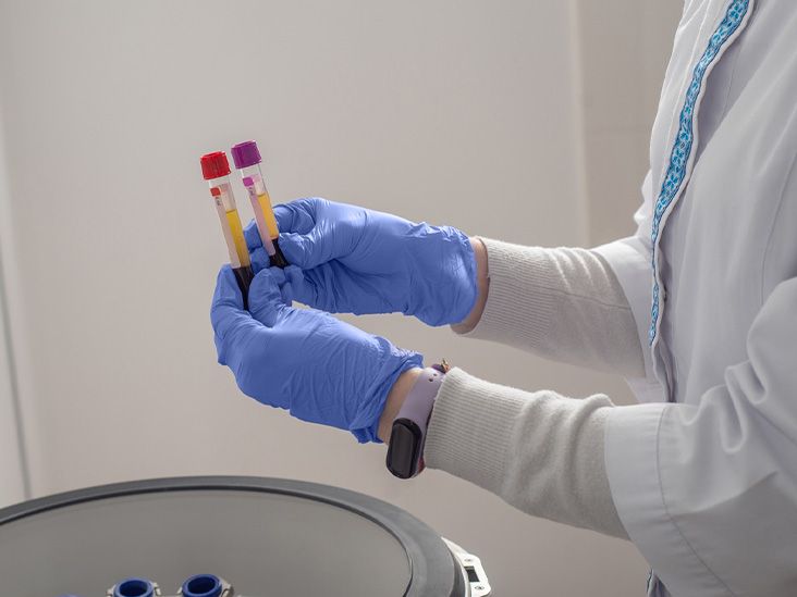 New RNA-based blood test shows promise for earlier Alzheimer’s detection
