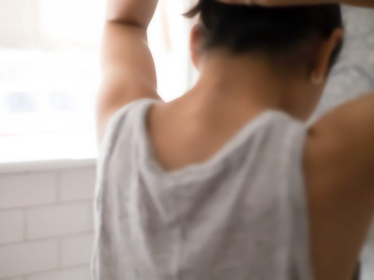 Arthritis drug may help regrow up to 80% of hair in alopecia areata