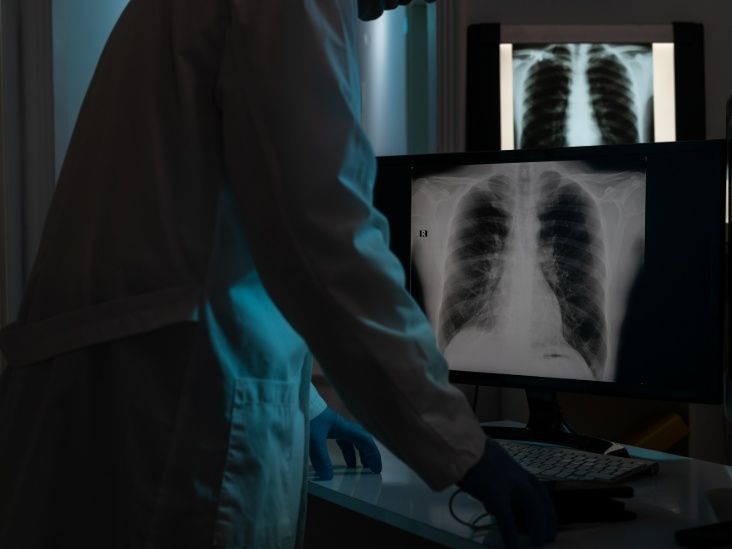 Pancreatic cancer drug may also help fight treatment-resistant lung cancer