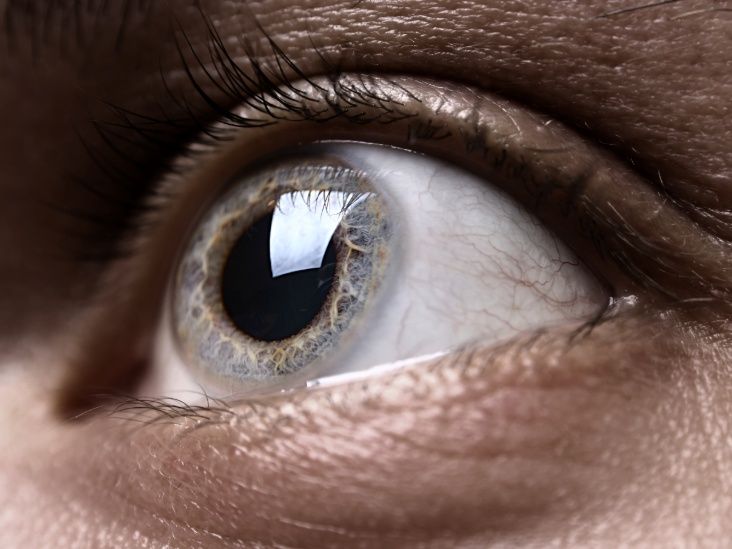 How changes in the eyes may help spot AFib risk years early