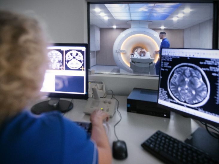 AI boosts brain aneurysm detection by 39 % in real - world study