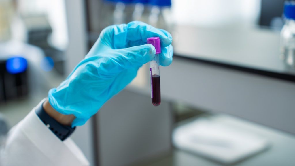A healthcare professional holding a blood vial. 