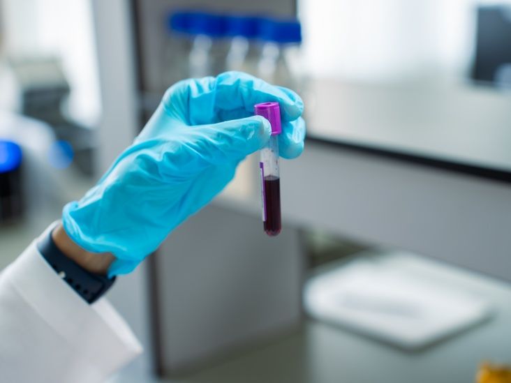 Pancreatic cancer: New AI blood test may lead to earlier detection
