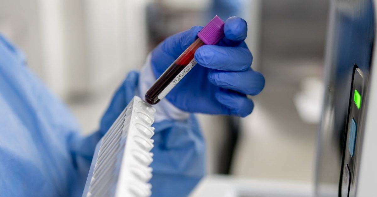 Blood proteins may signal prostate cancer risk 15 years pre