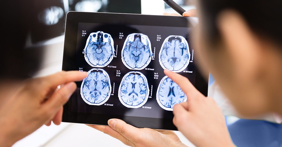 fMRI vs. SPECT Scan for the Brain