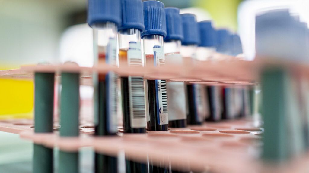 Blood test vials to test for bipolar disorder in preliminary trials