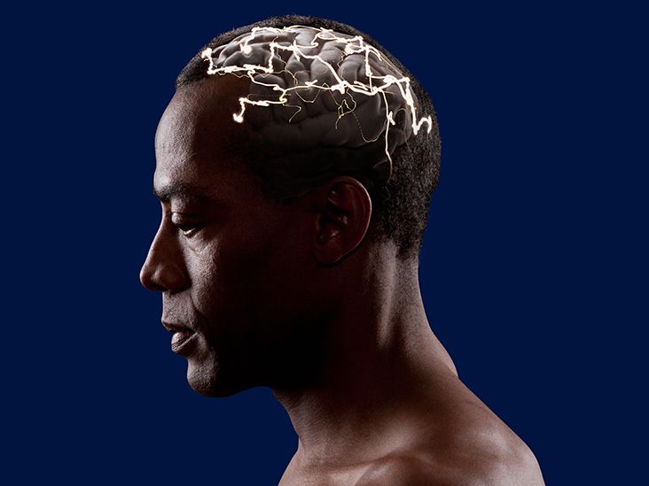 Shock Therapy for Depression Is It Effective?