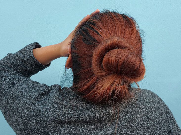 What I’ve Learned By Being Open About Migraine in Public