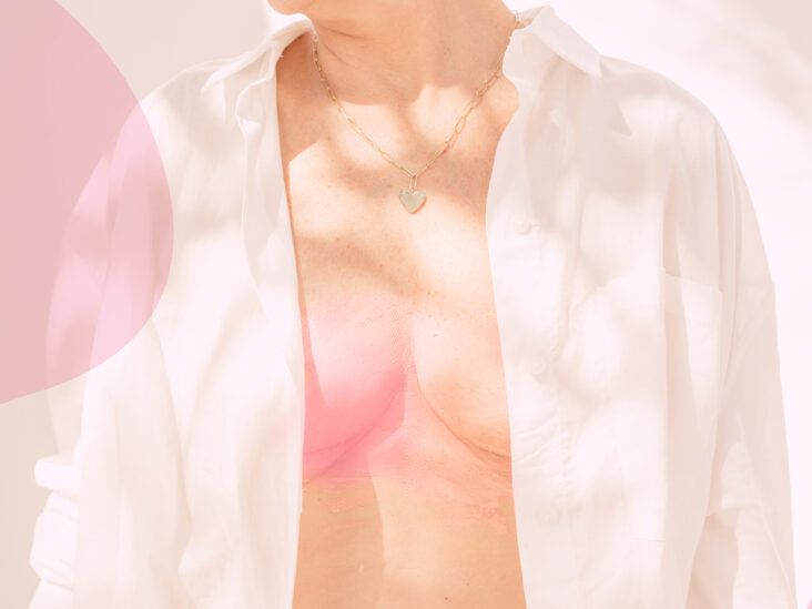 What's a Lumpectomy? (And Is It Right for You?)