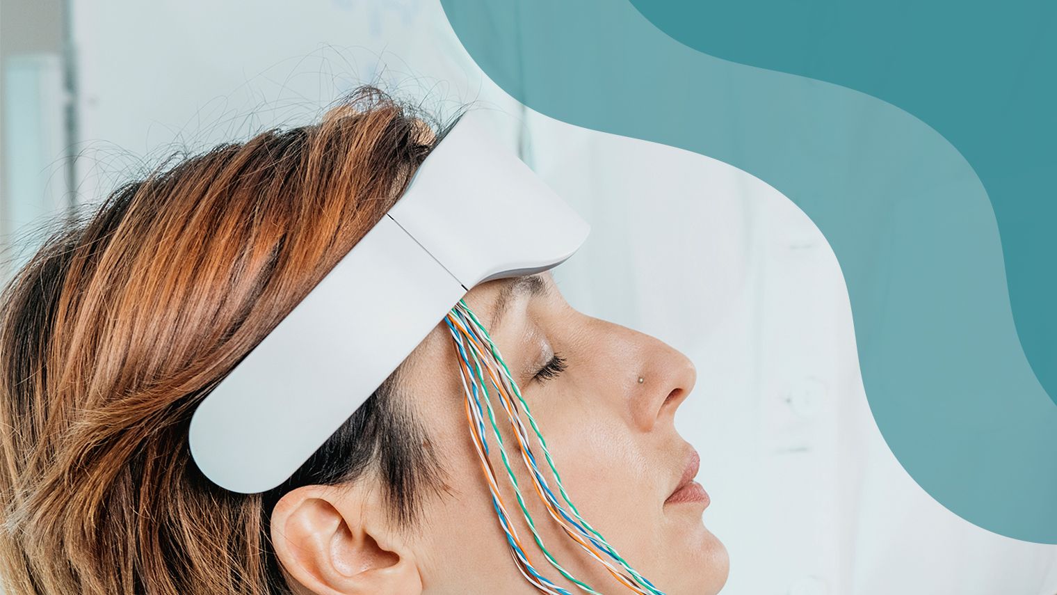 Can Electrical Nerve Stimulation Treat Migraine?