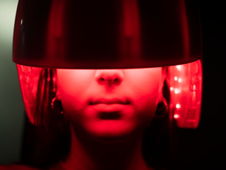 Do Laser Treatments for Migraine Work?