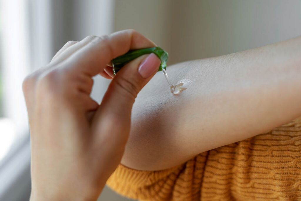 A person applying aloe vera gel to their arm, one of several natural remedies for psoriasis.