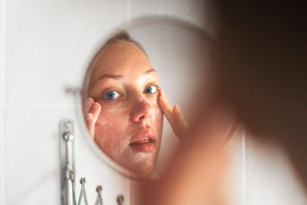 A person looking in a mirror and applying a lotion to their face to represent treatment for psoriasis on the face.