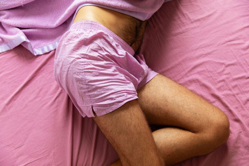 A masculine person experiencing scrotum eczema in pink boxer shorts shown from the waist down in a pink bed.