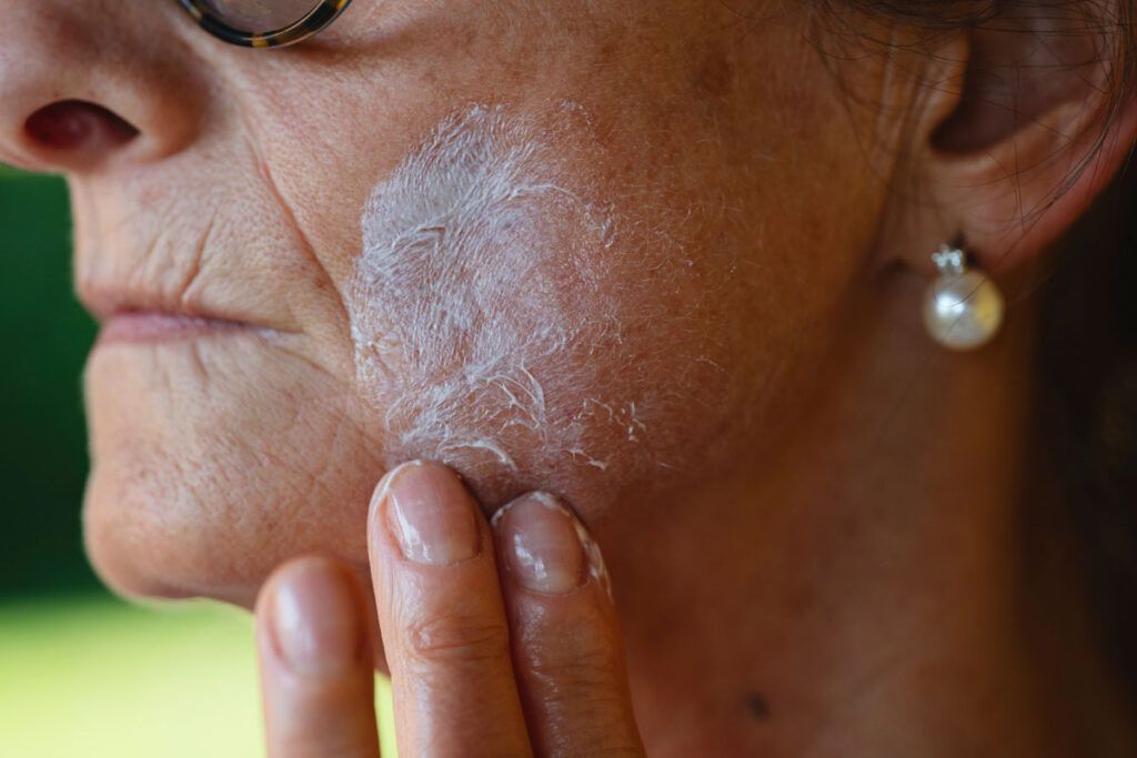 A close up of an older adult applying a cream to their face. It may be retinol or another retinoid.