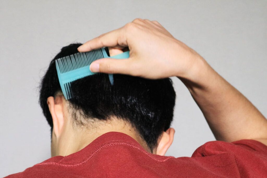 What to know about minoxidil foam vs. liquid Optum Perks