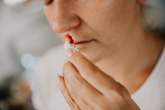A person holding a blood stained tissue to their nose to depict vitamin K deficiency bleeding.