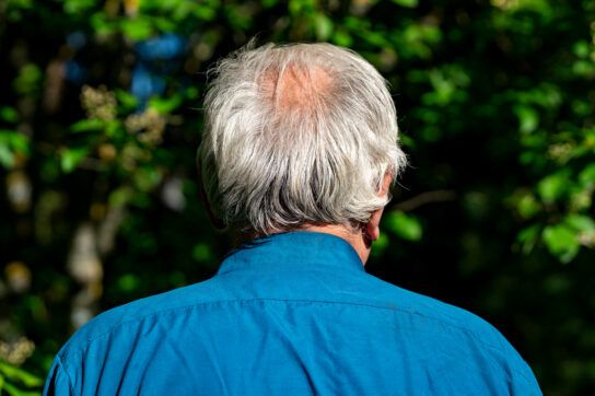 Older adult with their back turned so we can see the back of their head to depict hair loss.