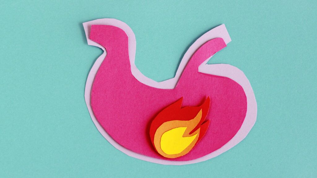 A felt cut-out of a pink stomach on a blue-green background with a flame inside the stomach depicting high levels of stomach acid.  
